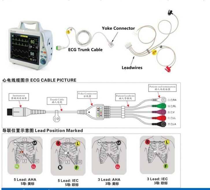 imagen ecg