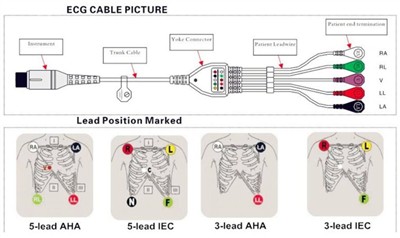 ¿Cómo conectar correctamente el cable de ECG con cables conductores a un moni...